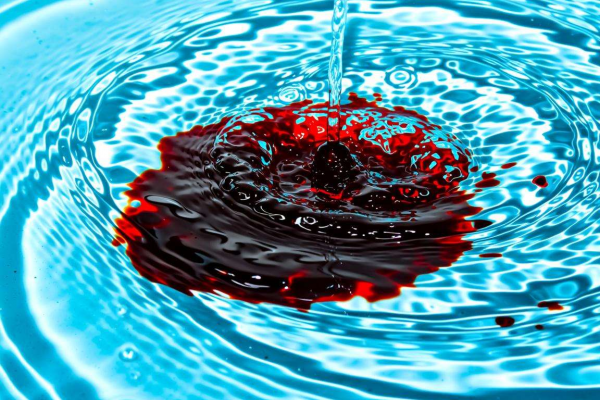 梦见自己尿血是什么意思，这些解读你需要知道